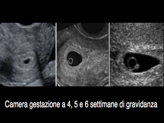 camera gestazionale a 4 settimane di gravidanza