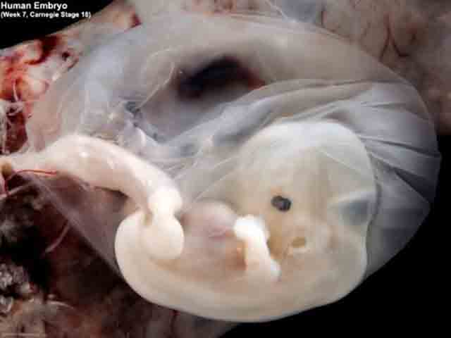 embrione alla 7 settimana di gravidanza