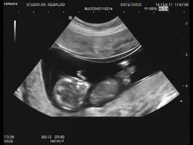 feto 12 settimane