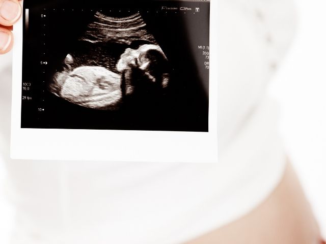 feto 3 mesi