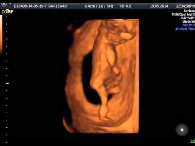feto di 12 settimane