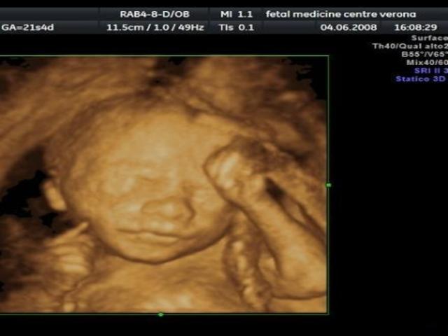 feto di 16 settimane