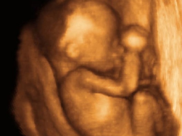 feto a 22 settimane