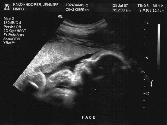 ecografia 28 settimana di gravidanza