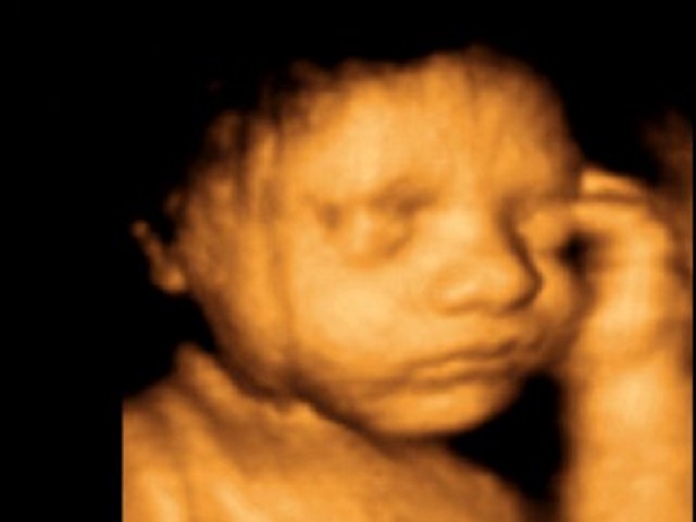 feto 31 settimane foto