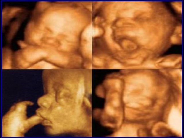 feto a 34 settimane